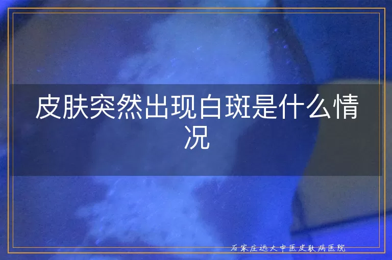皮肤突然出现白斑是什么情况