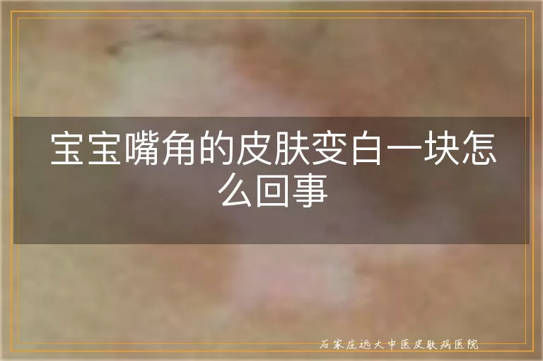 宝宝嘴角的皮肤变白一块怎么回事