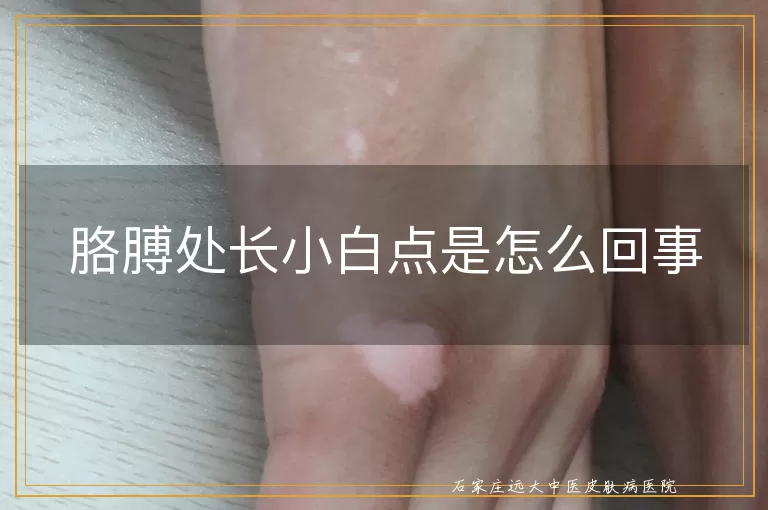 胳膊处长小白点是怎么回事