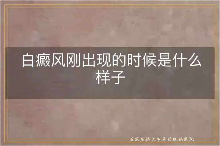 白癜风刚出现的时候是什么样子