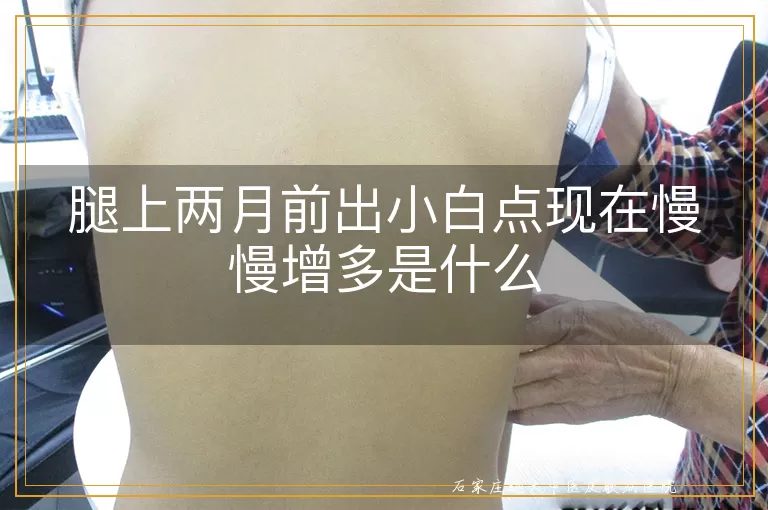 腿上两月前出小白点现在慢慢增多是什么