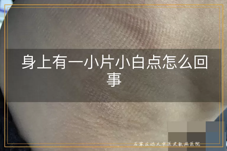 身上有一小片小白点怎么回事