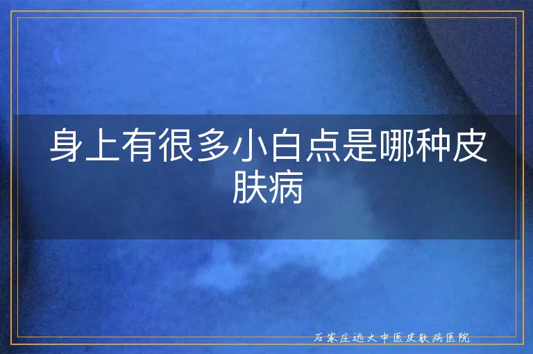 身上有很多小白点是哪种皮肤病