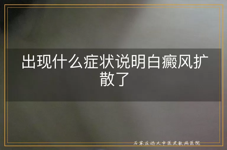 出现什么症状说明白癜风扩散了