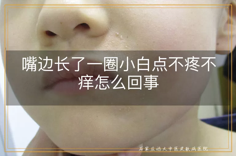 嘴边长了一圈小白点不疼不痒怎么回事