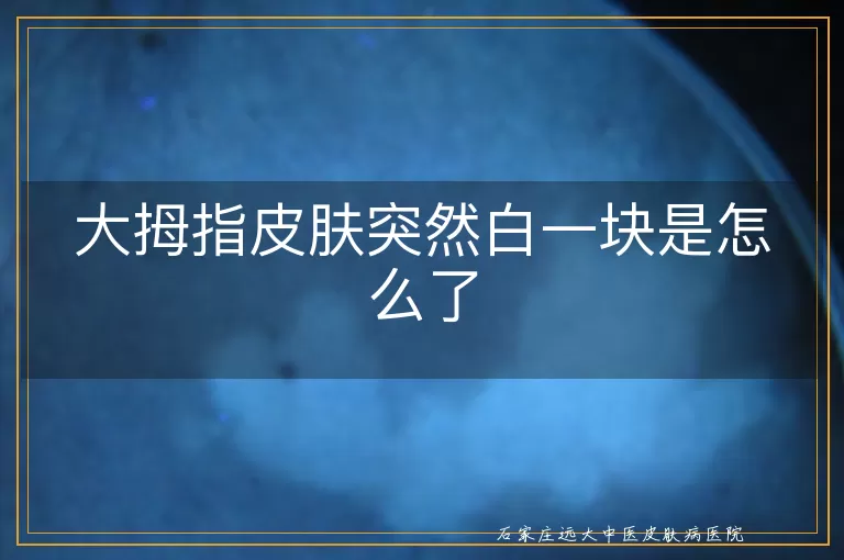 大拇指皮肤突然白一块是怎么了