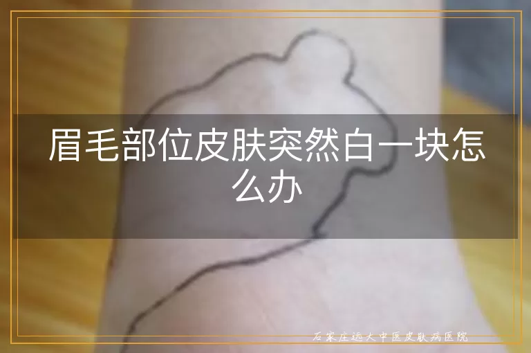 眉毛部位皮肤突然白一块怎么办