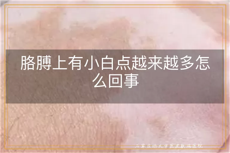 胳膊上有小白点越来越多怎么回事