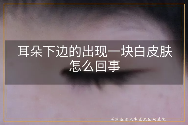 耳朵下边的出现一块白皮肤怎么回事
