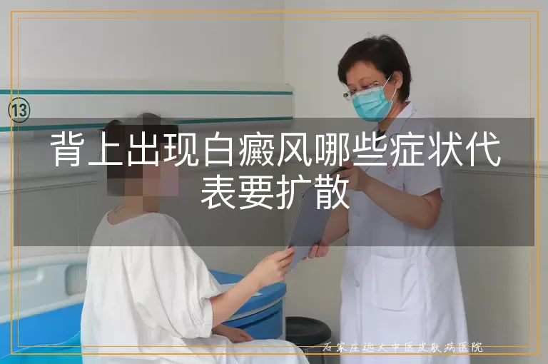 背上出现白癜风哪些症状代表要扩散
