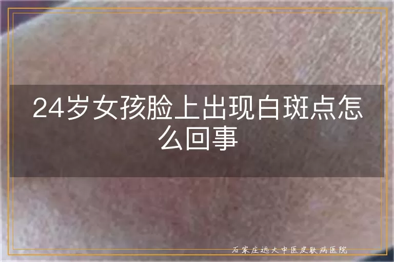 24岁女孩脸上出现白斑点怎么回事
