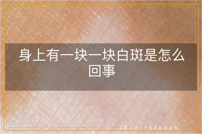 身上有一块一块白斑是怎么回事