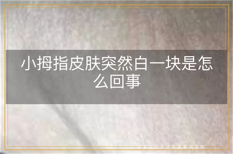小拇指皮肤突然白一块是怎么回事