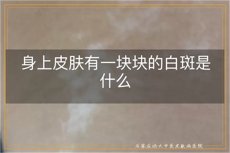 身上皮肤有一块块的白斑是什么