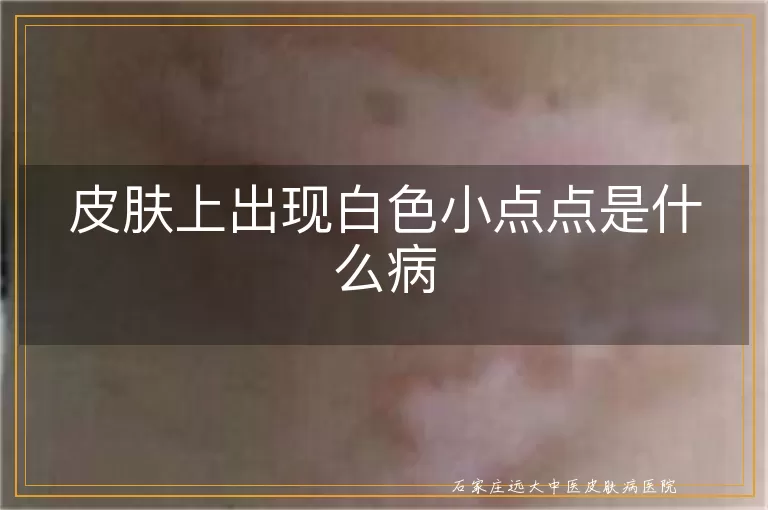 皮肤上出现白色小点点是什么病