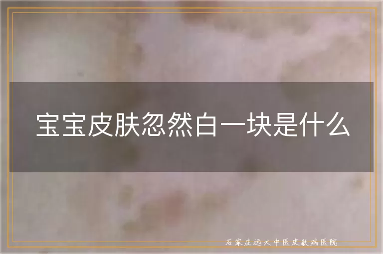 宝宝皮肤忽然白一块是什么