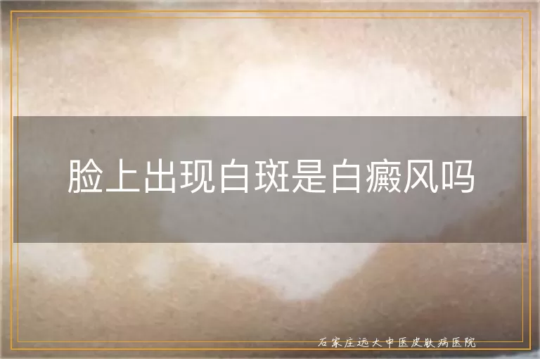 脸上出现白斑是白癜风吗