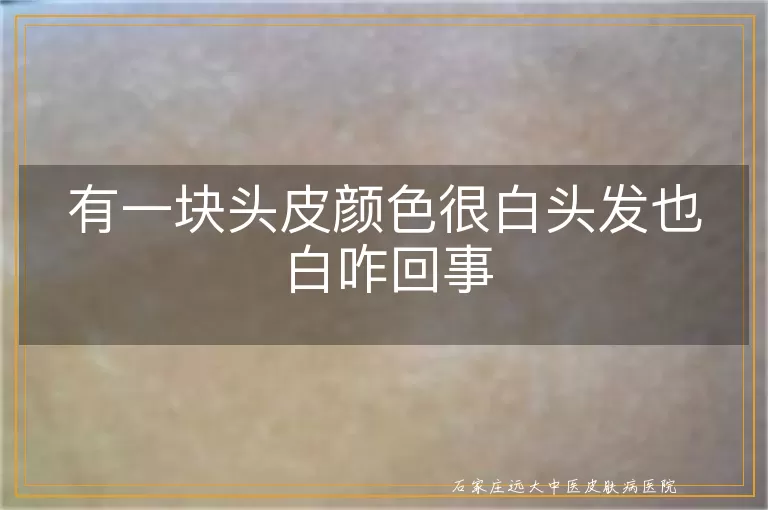 有一块头皮颜色很白头发也白咋回事