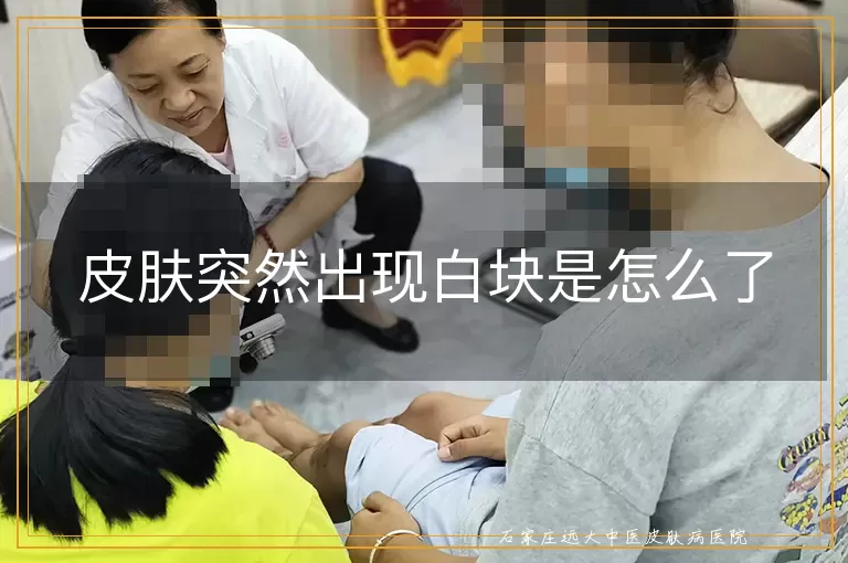 皮肤突然出现白块是怎么了