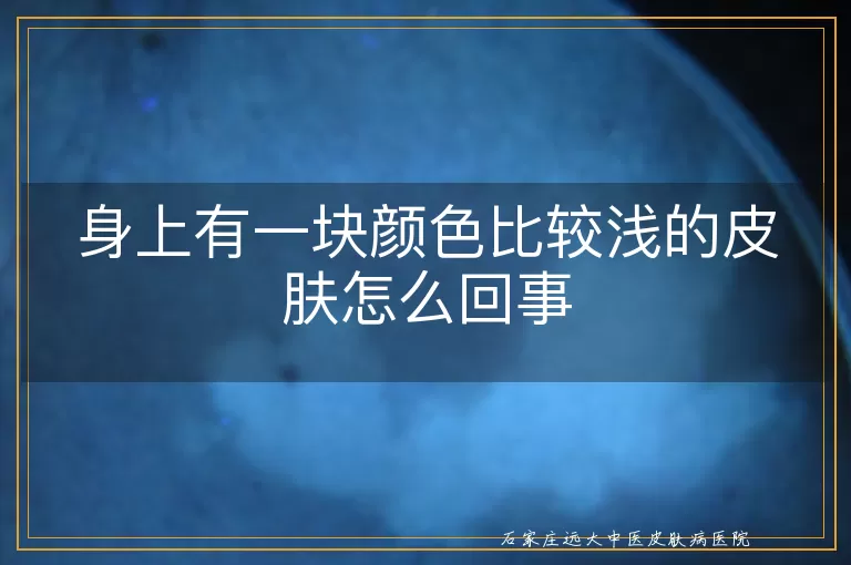 身上有一块颜色比较浅的皮肤怎么回事
