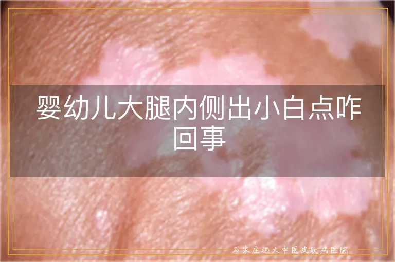 婴幼儿大腿内侧出小白点咋回事