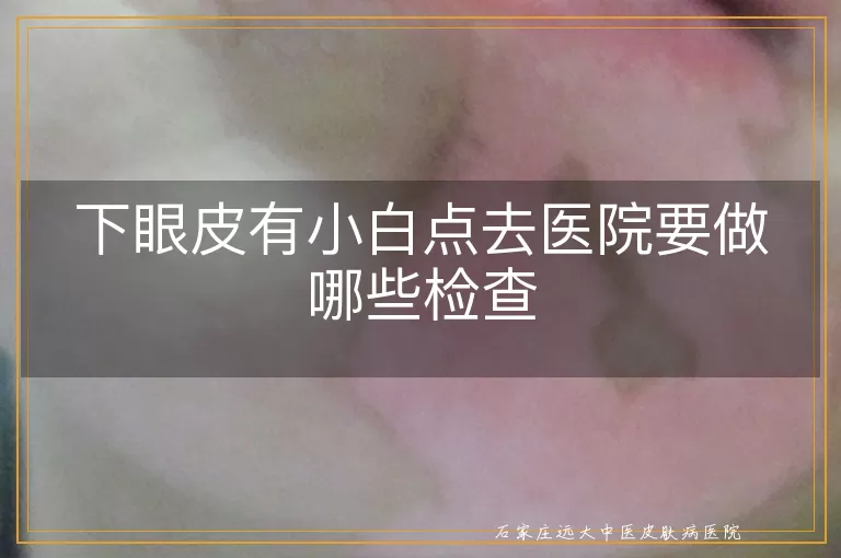 下眼皮有小白点去医院要做哪些检查