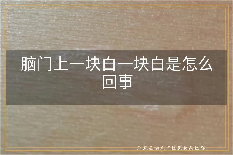 脑门上一块白一块白是怎么回事