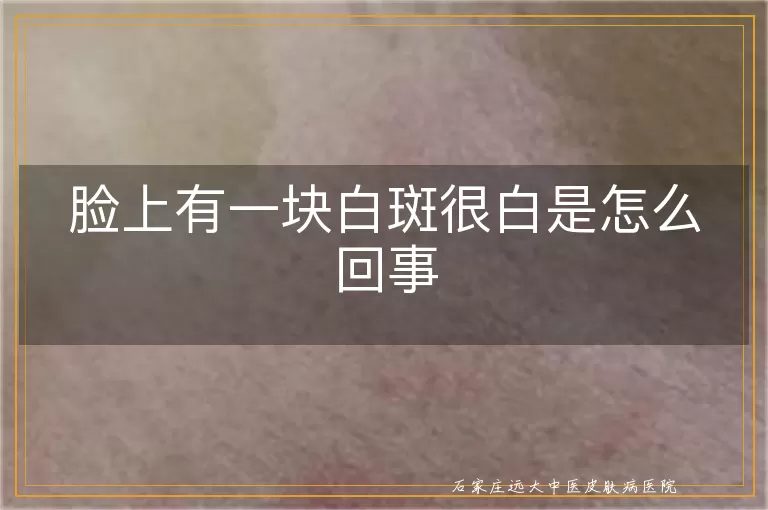 脸上有一块白斑很白是怎么回事