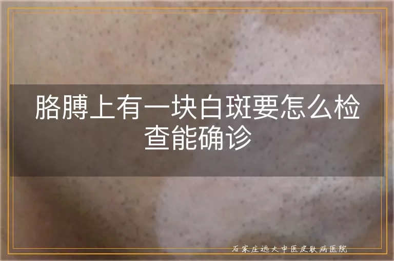 胳膊上有一块白斑要怎么检查能确诊