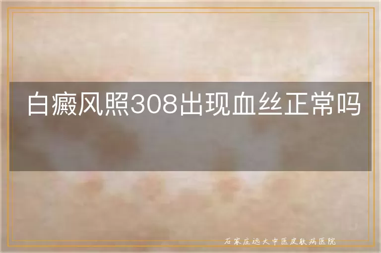 白癜风照308出现血丝正常吗