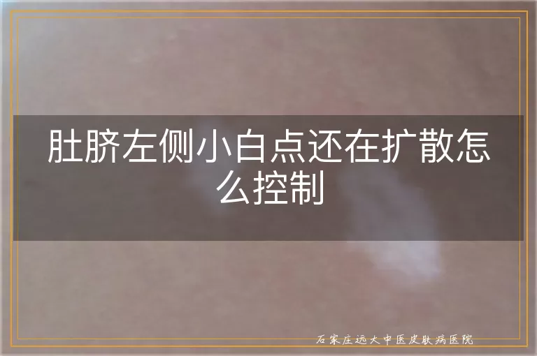 肚脐左侧小白点还在扩散怎么控制