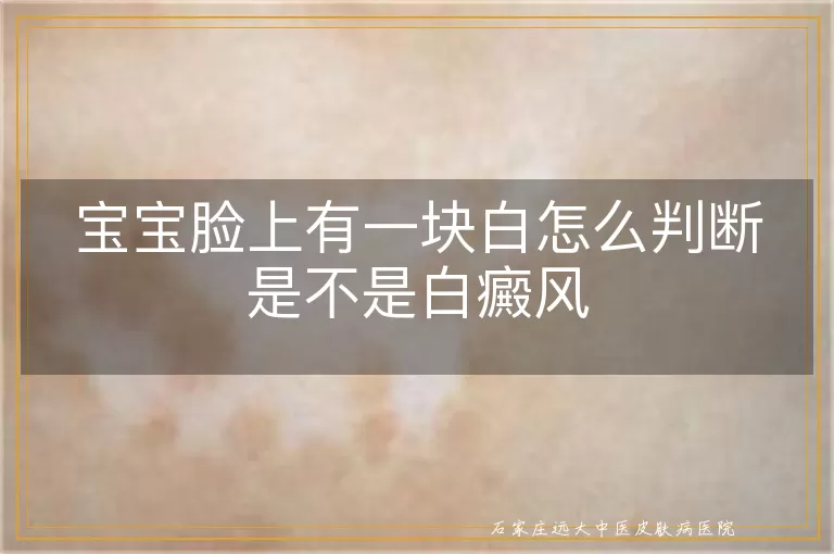 宝宝脸上有一块白怎么判断是不是白癜风