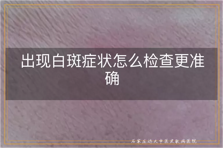 出现白斑症状怎么检查更准确