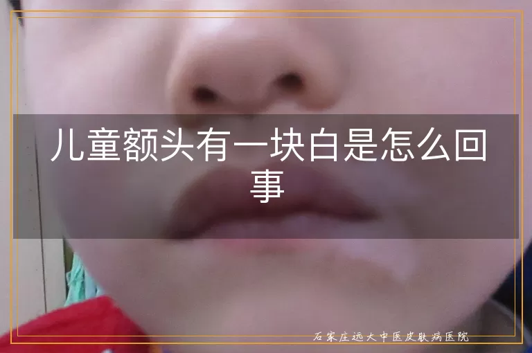 儿童额头有一块白是怎么回事