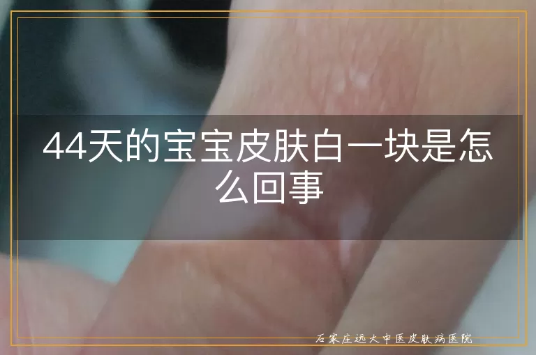 44天的宝宝皮肤白一块是怎么回事
