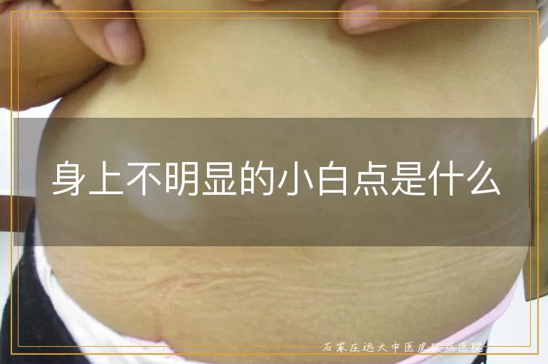 身上不明显的小白点是什么