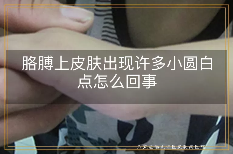胳膊上皮肤出现许多小圆白点怎么回事
