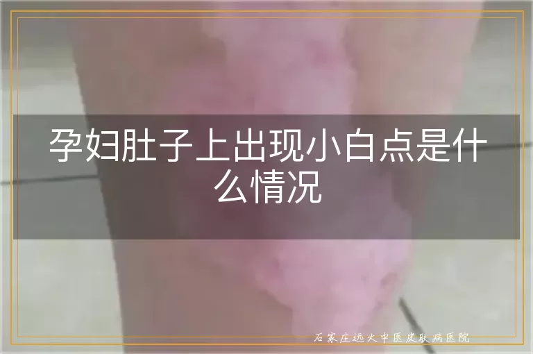 孕妇肚子上出现小白点是什么情况