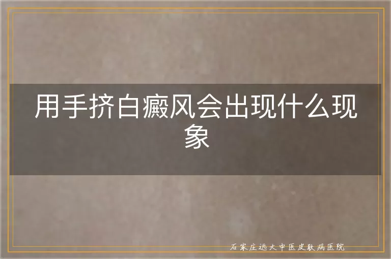 用手挤白癜风会出现什么现象