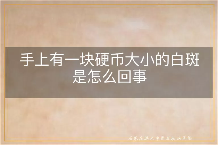 手上有一块硬币大小的白斑是怎么回事