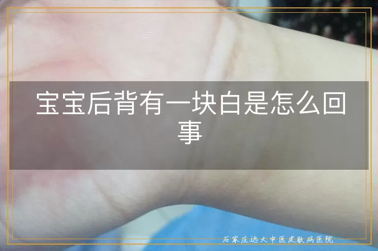 宝宝后背有一块白是怎么回事