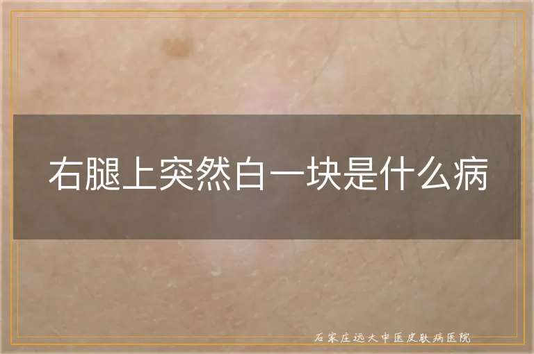 右腿上突然白一块是什么病