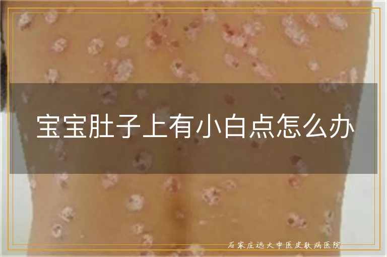 宝宝肚子上有小白点怎么办