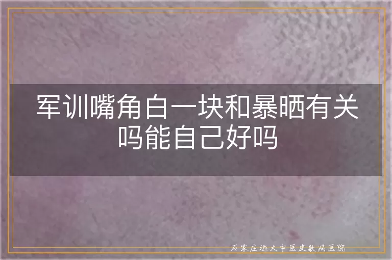 军训嘴角白一块和暴晒有关吗能自己好吗