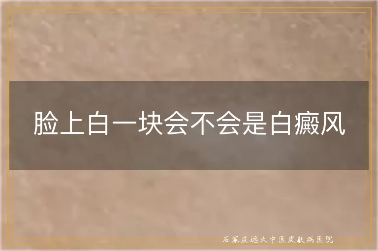 脸上白一块会不会是白癜风