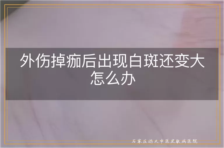 外伤掉痂后出现白斑还变大怎么办