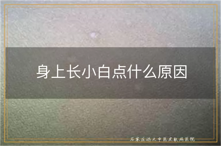 身上长小白点什么原因