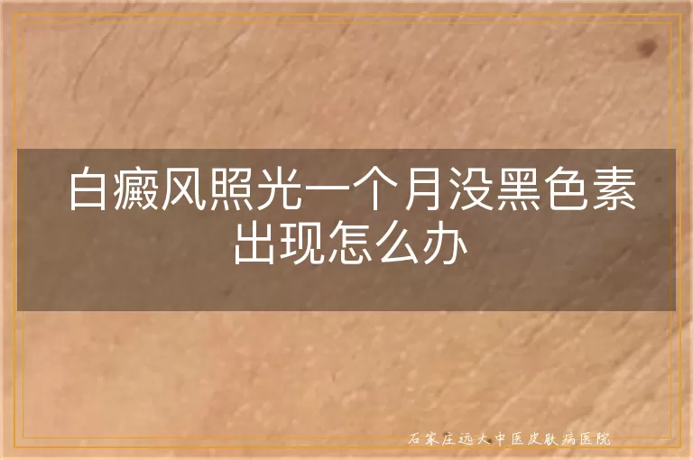 白癜风照光一个月没黑色素出现怎么办