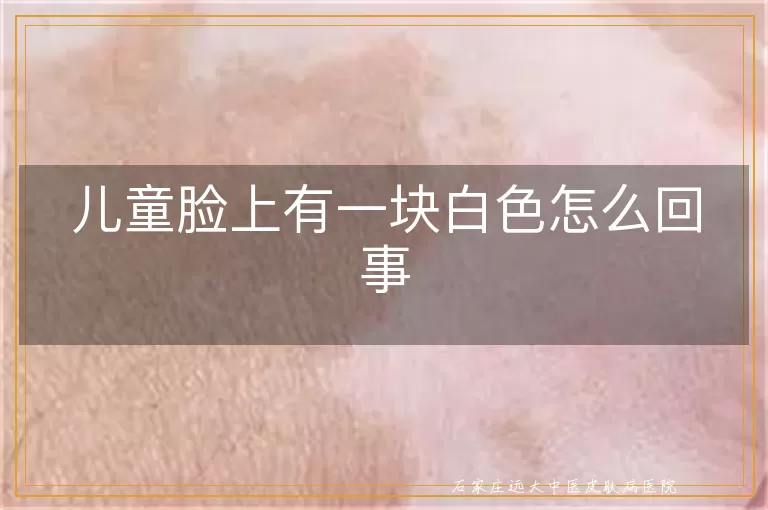 儿童脸上有一块白色怎么回事