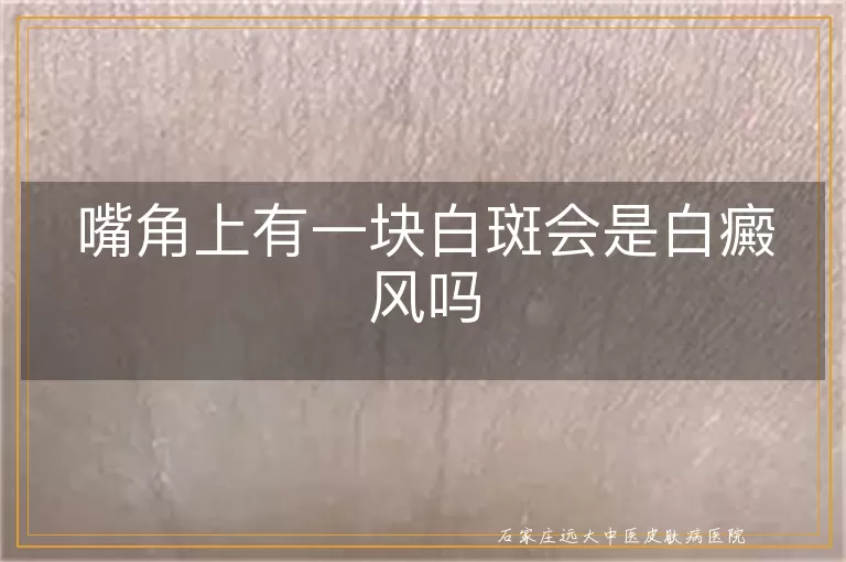 嘴角上有一块白斑会是白癜风吗
